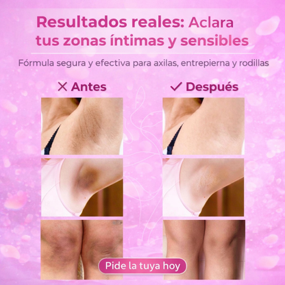 ¡OFERTA DE HOY!⌛CREMA BLANQUEADORA 2X1 +ENVIO GRATIS🏡🚚